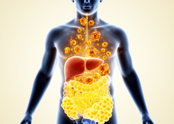 High serum urate linked to visceral and liver fat in obesity study