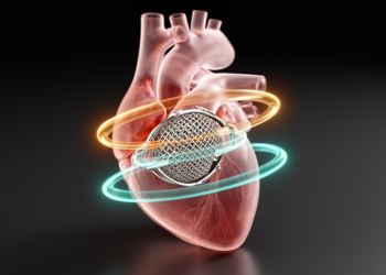 Planned and actual valve planes differ in every TAVR patient studied