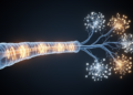 Machine learning sorts Guillain-Barré syndrome subtypes from nerve conduction data