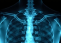 Wavelets Meet Mamba: AI Reads Shoulder X-rays to Spot Rotator Cuff Tears