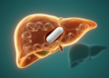 Olanzapine binds hepatic protein Orm2 in drug-linked liver fat study