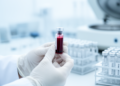 Blood Test for Early Alzheimer's Detection Stays Stable Across Storage Conditions
