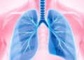 Simple Blood Ratio Predicts Death Risk in Sepsis-Linked Lung Failure Patients