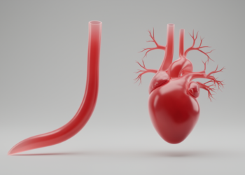 Sudanese Angiography Study Finds Women's Coronary Arteries Are Longer and More Tapered Than Men's