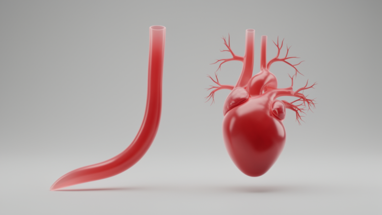 Sudanese Angiography Study Finds Women's Coronary Arteries Are Longer and More Tapered Than Men's