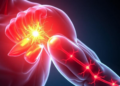 Omega-3-derived lipid Resolvin E1 rejuvenates aged muscle healing by resolving inflammation