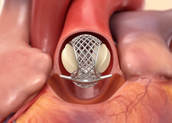 Valve Migration After TAVR Unmasked Hidden Behçet Disease in One Patient