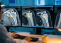 Deep-learning network pinpoints shoulder landmarks on CT scans