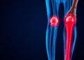 Pain, motivation and digital help: what adults with hip and knee osteoarthritis say they need