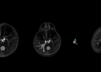 From small 1997 initiative to one of Europe's largest breast imaging societies