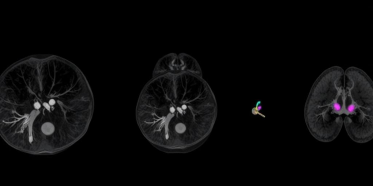From small 1997 initiative to one of Europe's largest breast imaging societies