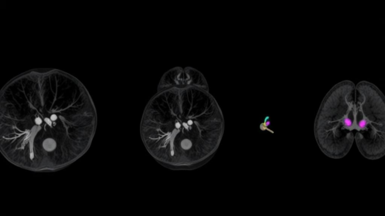 From small 1997 initiative to one of Europe's largest breast imaging societies