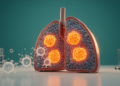 S100P Emerges as a Prognostic and Immune-Linked Biomarker in Lung Adenocarcinoma