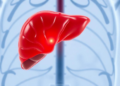 Gene Mutations After Liver Transplantation May Reveal Which Liver Cancer Patients Face Recurrence