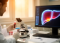 Biomarker model predicts severe amoebic liver abscess in Iraqi patients