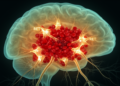 Astrocytic RET protein shields neurons after brain hemorrhage in mouse study