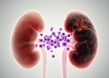 Severe Baseline Kidney Impairment Predicts Long-Term Kidney Failure Risk in Myeloma