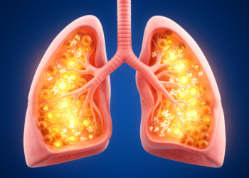How Metabolic Reprogramming May Drive Refractory Pneumonia in Children
