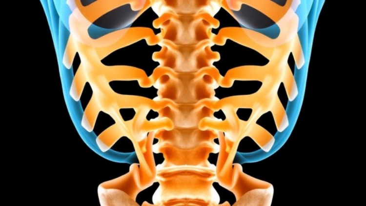 Kambin's Triangle Route for Vertebroplasty Shows Shorter Operations in Retrospective Study