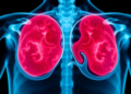 Five-year survival reaches 73.2% in population-based study of soft tissue sarcomas