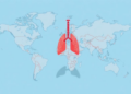 Exercise During Chemotherapy: New Evidence Map Sets Safety Rules for Lung Cancer Patients