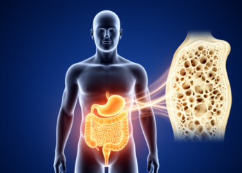Body shape indices linked to bone loss in diabetes and prediabetes, NHANES analysis finds