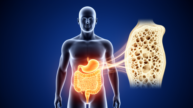 Body shape indices linked to bone loss in diabetes and prediabetes, NHANES analysis finds