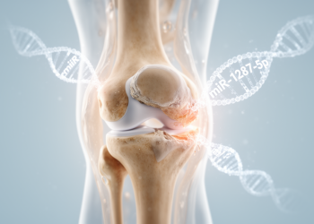Serum microRNA miR-1287-5p emerges as a candidate biomarker and driver of knee osteoarthritis