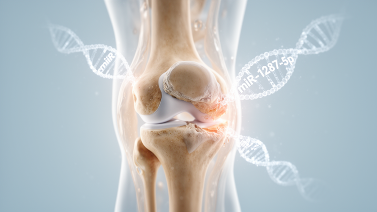 Serum microRNA miR-1287-5p emerges as a candidate biomarker and driver of knee osteoarthritis