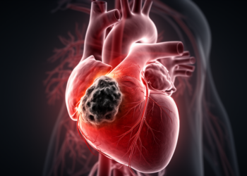 Cardiac sarcoma: new diagnostic framework proposed from two rare left atrial cases