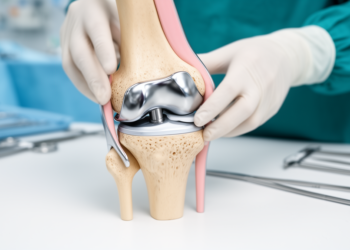 Knee replacement after failed osteotomy: review finds unicompartmental implants may deserve a second look