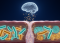 Gut Microbiome Signals Track Alzheimer's Disease, but Treatments Remain Experimental