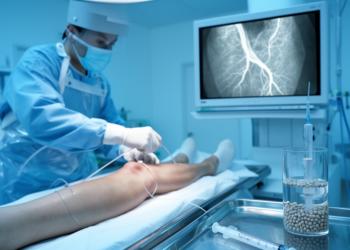 From Stopping Bleeds to Easing Knee Pain: How Embolization Is Reshaping Musculoskeletal Care