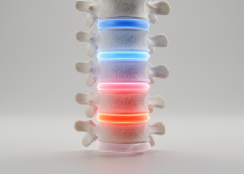 Lumbar Posture Reshapes Disc Stress in Finite Element Spine Model