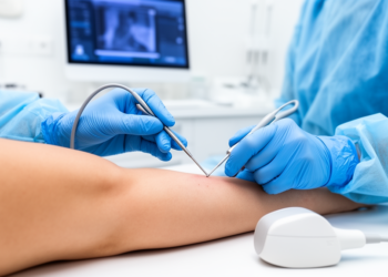 Freezing Nerves: Small Case Series Reports Lasting Spasticity Relief