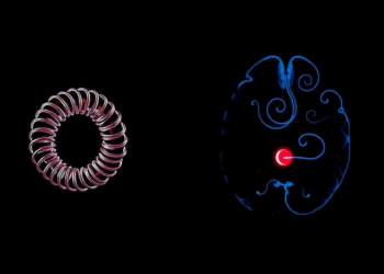 Coils or Clips? Landmark Analysis Reveals Which Aneurysm Repair Wins Where