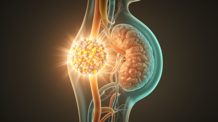 Radioligand therapy reshapes treatment outlook for rare adrenal nerve tumors