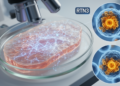 AI Reads Bladder Cancer Slides and Pinpoints RTN3 Behind Chemotherapy Resistance