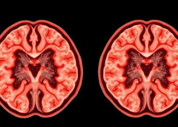 Two Cancer Genes Pull in Opposite Directions in Papillary Thyroid Tumors
