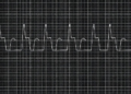 EEG Slow-Wave Patterns Track Oxcarbazepine Response in Focal Epilepsy