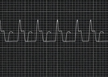 EEG Slow-Wave Patterns Track Oxcarbazepine Response in Focal Epilepsy