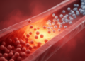 Immune Cells Skew Toward Inflammation in Children With Newly Diagnosed ITP