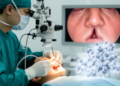 Protein Linked to Re-Blocked Tear Ducts After Keyhole Eye Surgery