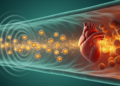 Ultrasound-Triggered Nanoparticles Deliver Herbal Extract to Shield Irradiated Hearts