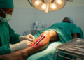 Implant Infections After Bone Nailing Hit 8.5% in Ethiopian Tertiary Hospital