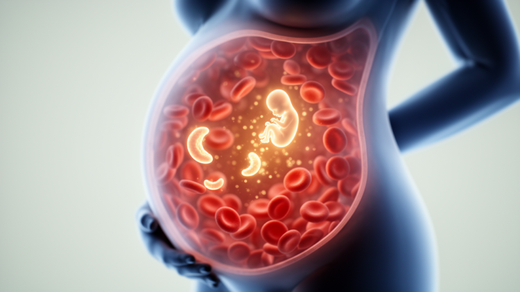 Model suggests replacing father blood tests with NIPT would raise England's sickle cell screening costs