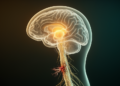 Thalamus Remodeling May Drive Neuropathic Pain After Spinal Cord Injury