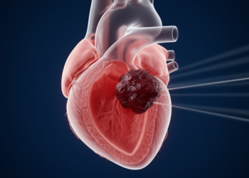 Imaging Teamwork Caught Rare Right-Ventricular Thrombi in Inherited Heart Disease