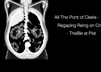 AI Spots Missed Timing in Abdominal CT Scans, Revealing Who Is Most at Risk