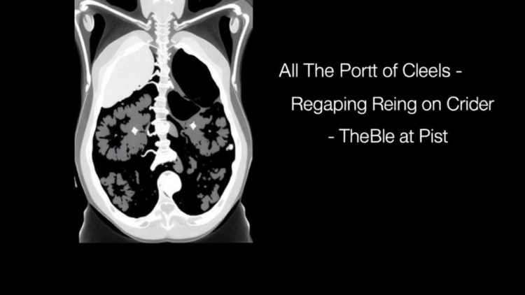 AI Spots Missed Timing in Abdominal CT Scans, Revealing Who Is Most at Risk
